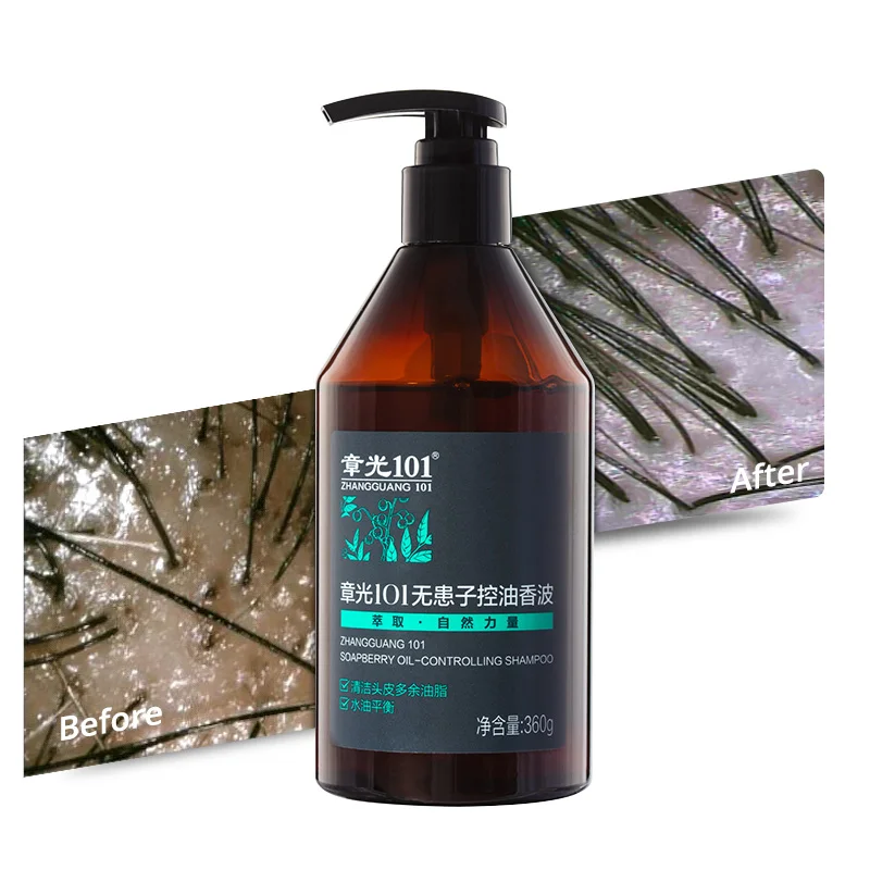 Manufacturer Zhangguang 101 Best Oil Control Anti Hair Loss Shampoo 360g