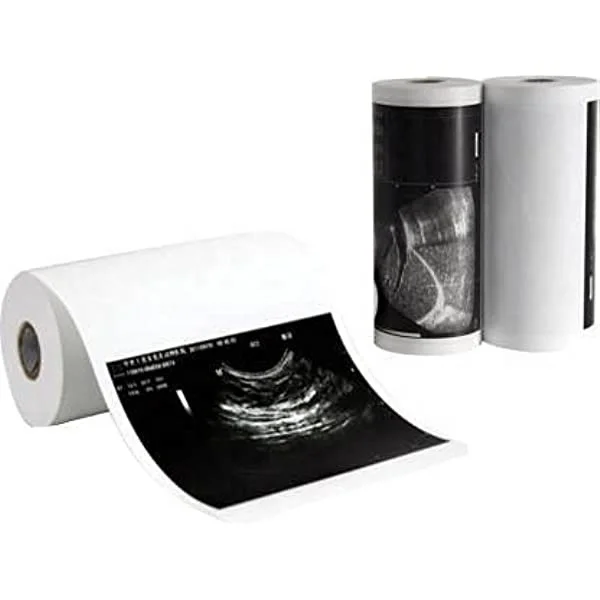 high gloss 110hg thermal ultrasound paper type v