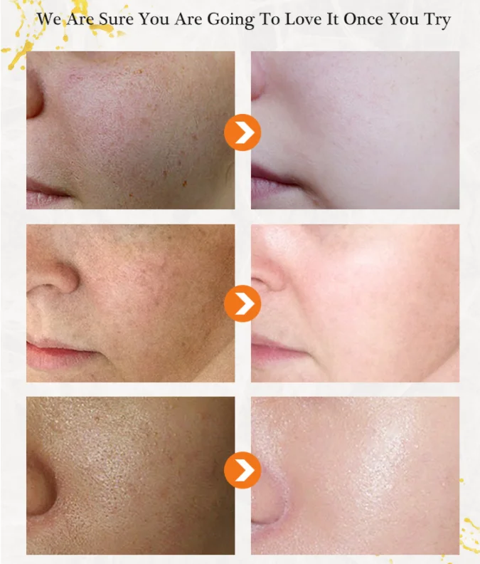 OEM best Arbutin Retinol anti aging bleaching lightening creams without hydroquinone  night cream and day cream set