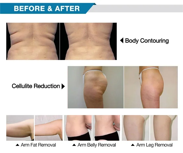 2024 newest RF EMS Body Sculpt Electromagnetic Pulses Body Electronic Muscle Stimulate EMS Machine