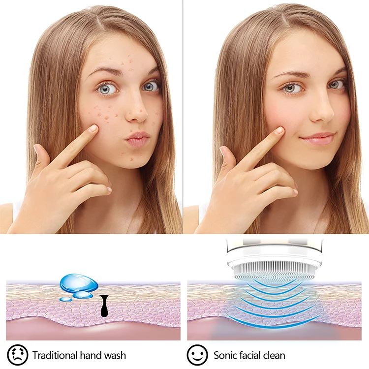 Лидер продаж на amazon 2019, силиконовая звуковая вибрационная Очистка лица