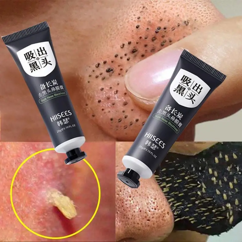 Cleansing Face Carbon Peel Gel Black Star Glow Facial Mask  Cream Nasal Patches Female Blackhead Remover mask