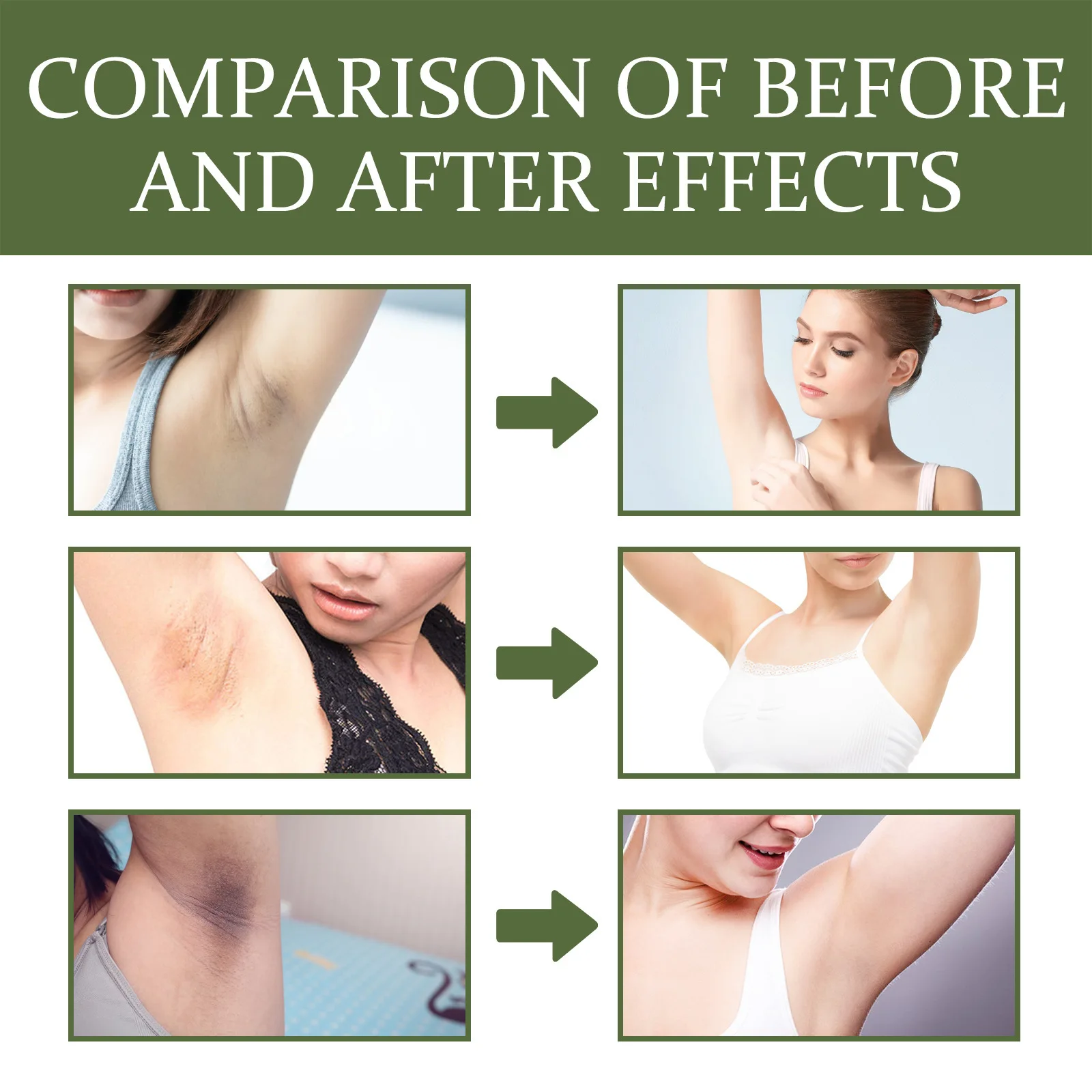 Armpit Brightening Cream Intimate Area Whitening Treatment Deeply Reduces Pigmentation Cream body care