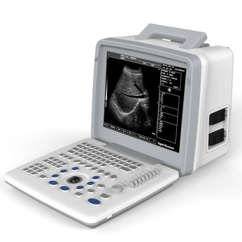 KBW-300 Laptop B&W Ultrasonic diagnostic portable B ultrasound scanner