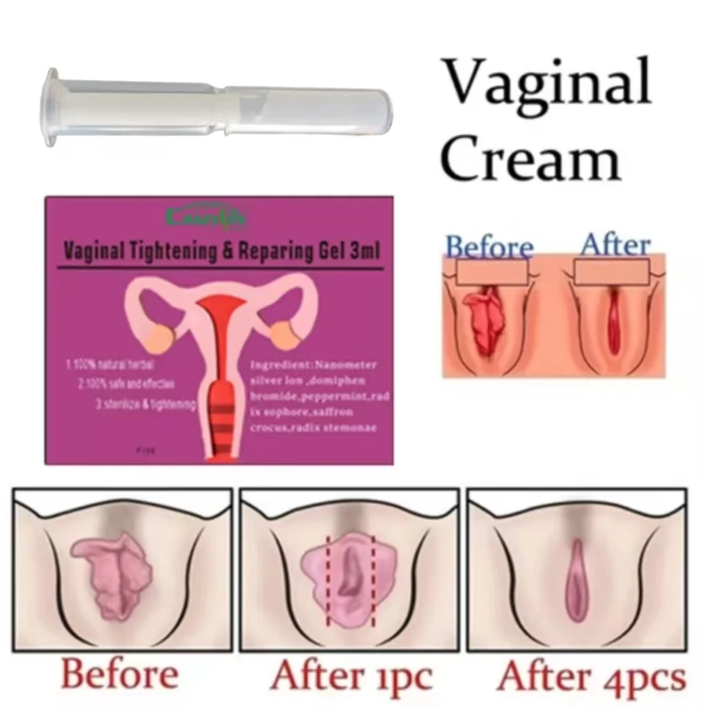 Antibacterial cleaning and maintenance Chinese Herbal vaginal Tightening Products Feminine Gel Shrink Feminine Hygiene Wholesale