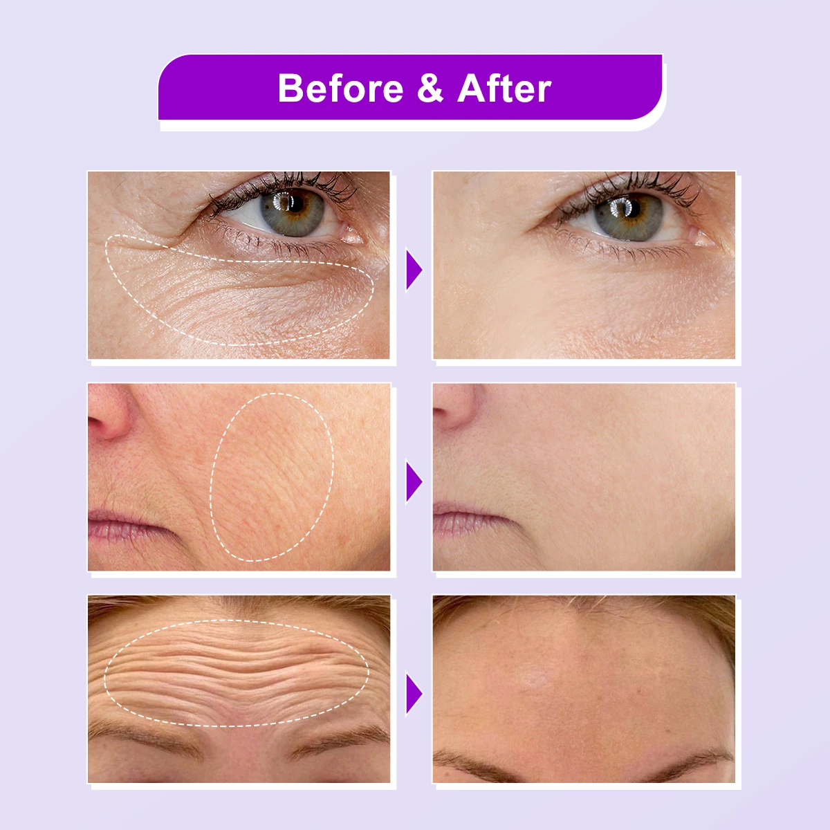 OEM/ODM Private label organic Brightening Moisturizing Anti Wrinkle Aging Retinol Alternative Smoothing Bakuchiol Serum