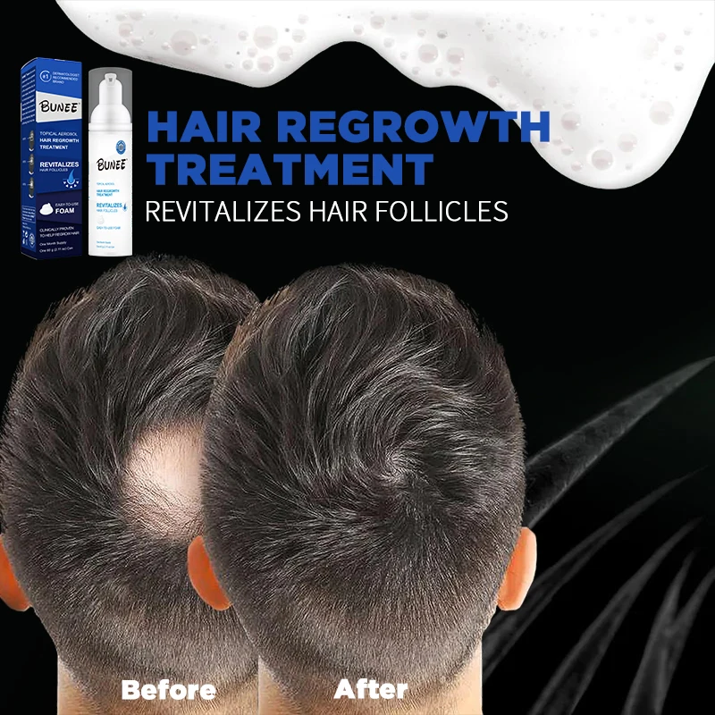 60ml reactivates hair follicles Topical solution Collagen biotin hair growth serum foam