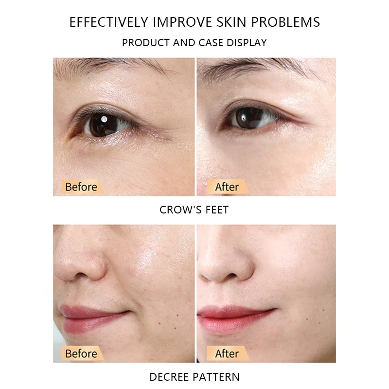 Low Moq Pure Moisturizing Hyaluronic Acid Facial Serum Anti-Wrinkle Hydrating And Anti-Aging Fibronectin Freeze-dried Powder