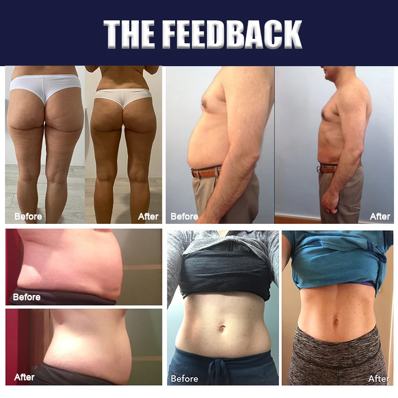 Winkonlaser 360 Cryolipolisis Slimming Cryolipolysis Machine Fat Freezing Cryo 4 Handles