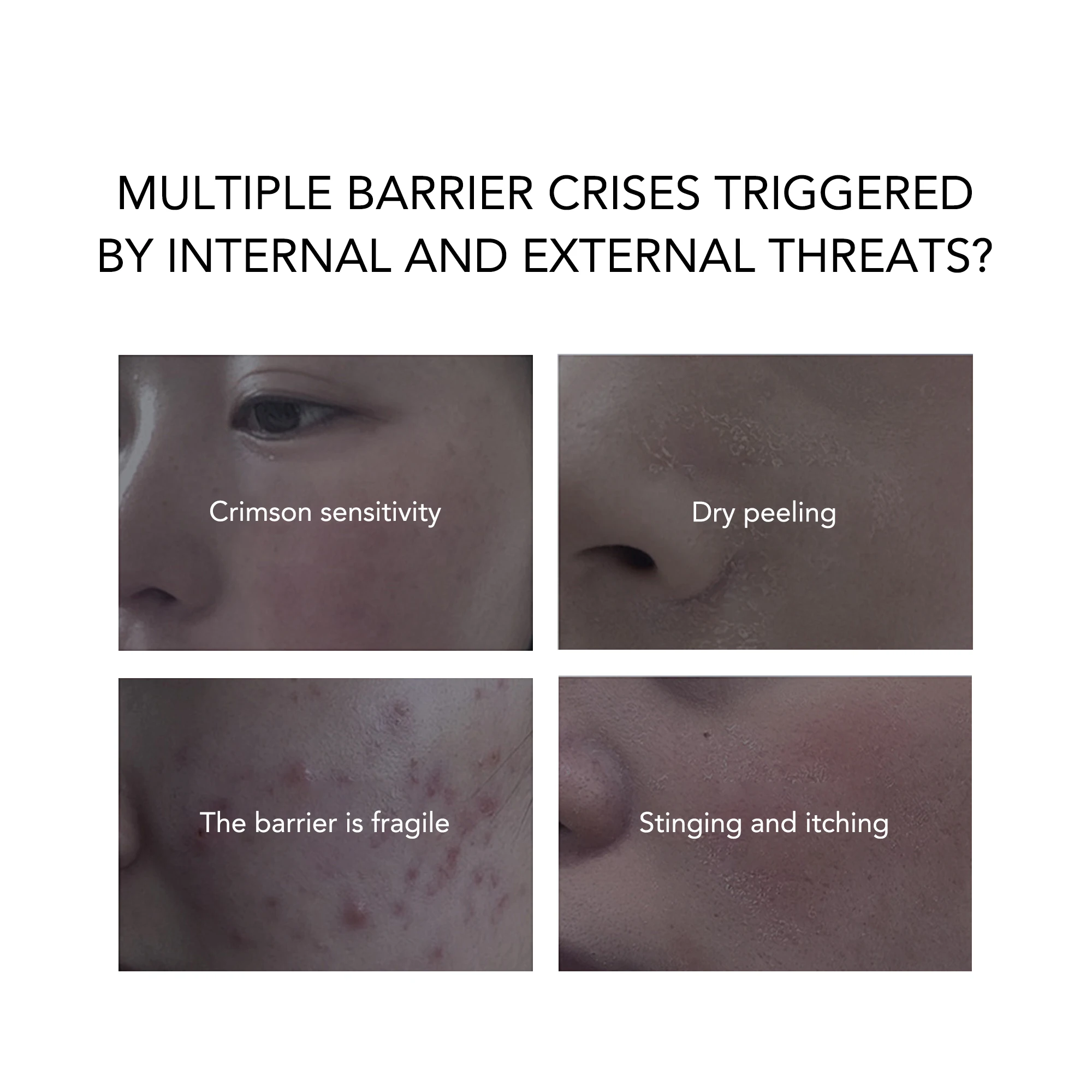 Private Label 20ml Camellia Seed Essence Factory Price Rejuvenating Repair Serum for Women Face with Pore Shrinking Feature