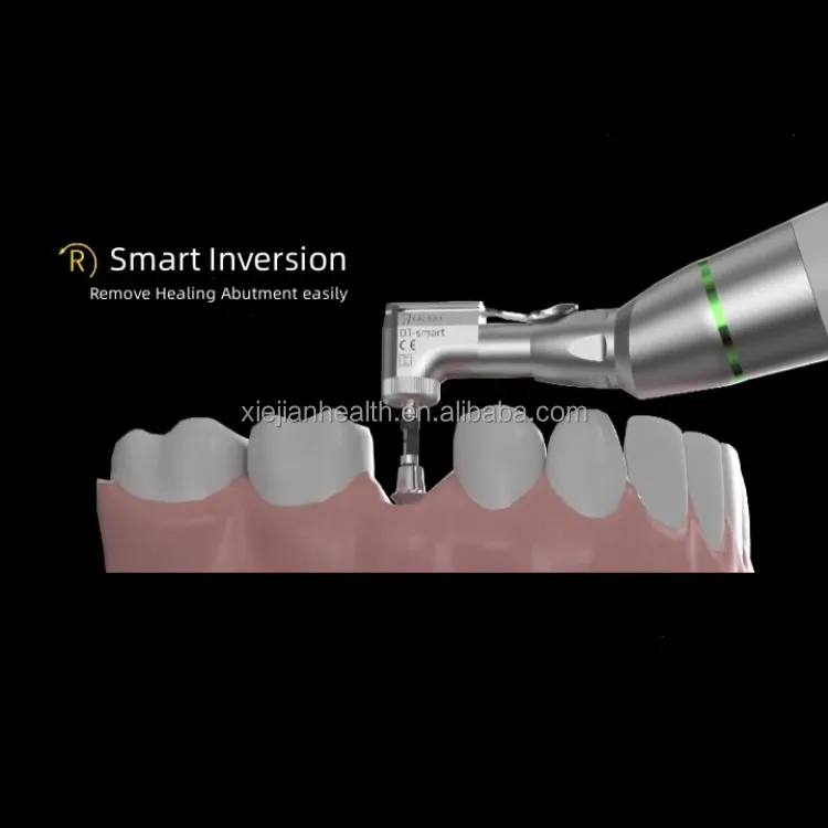 cordless implant (5).jpg