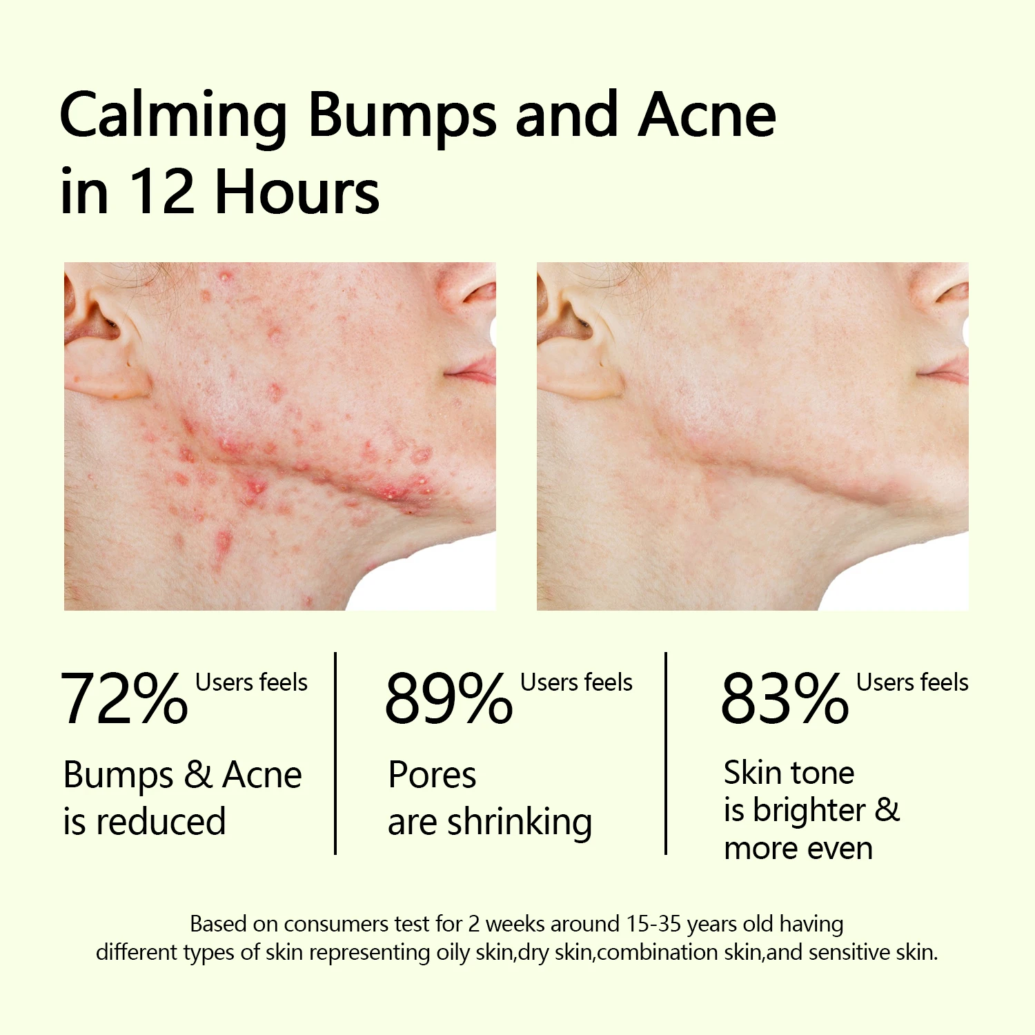 New Mugwort Mask Anti Pores & Acne Green Clay Mask Moisturizing Oil-Control Organic Vegan Mud Facial Mask