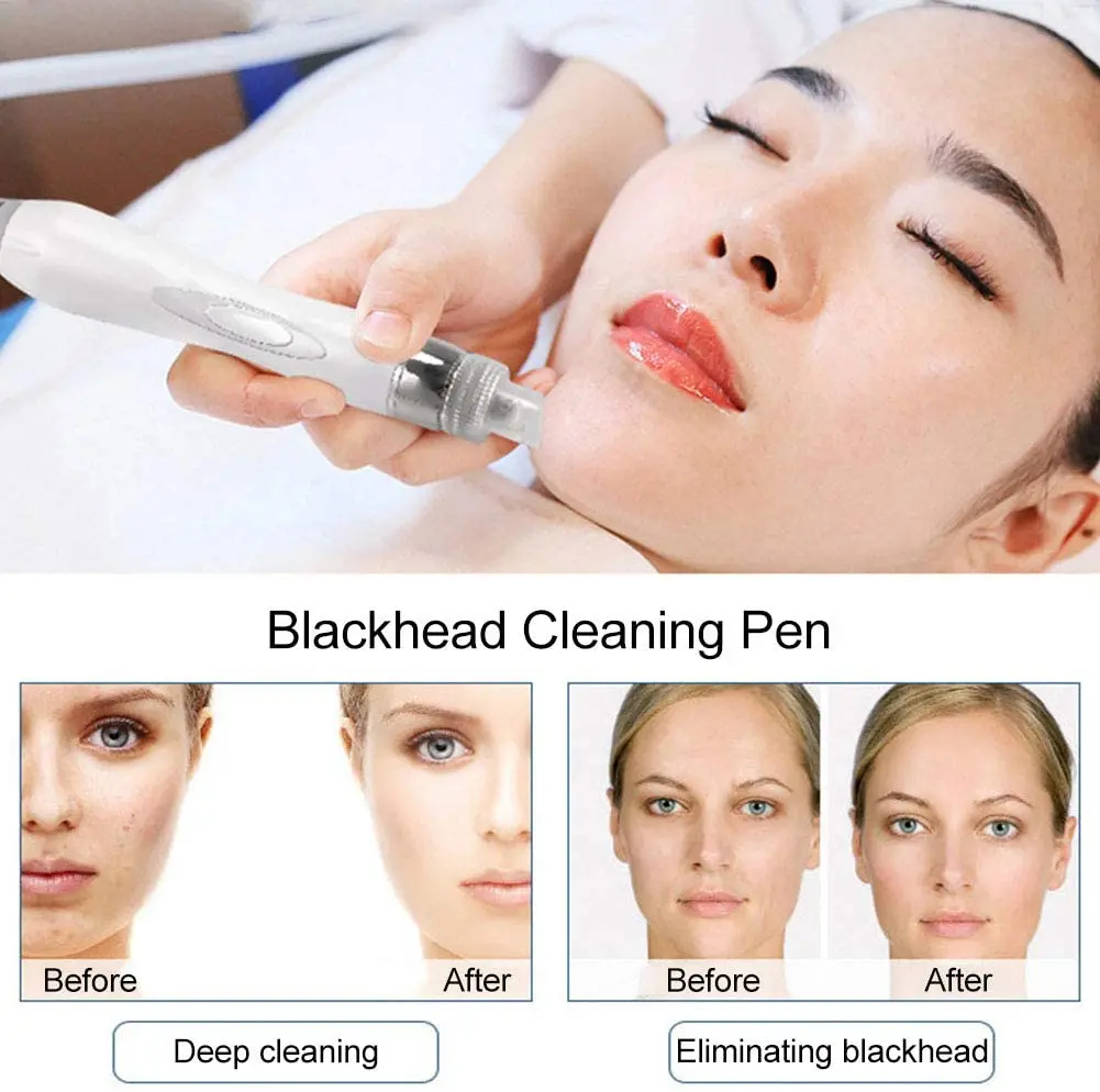 7 in 1 Hydro Oxygen Facial Machine Microdermabrasion Aqua Jet Peel Oxygen Cleansing Scrubber Facial Care Machine