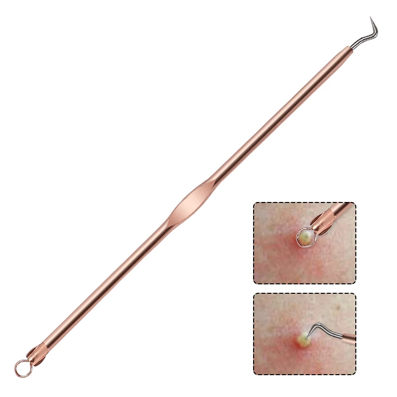 Professional Skin Care Tool 4PCS Stainless Steel Blackhead & Pimple Extractor Acne Remover Kit