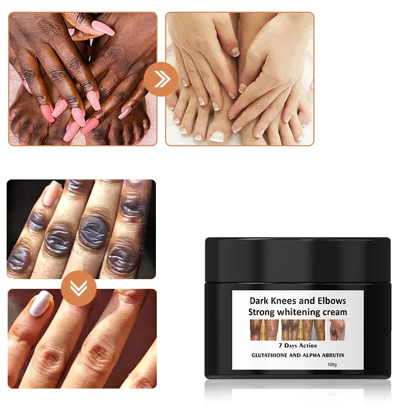 5D gluta Dark Knees and Elbows Strong Underarm Whitening Cream Armpit Fast Action Extreme Whitening Cream