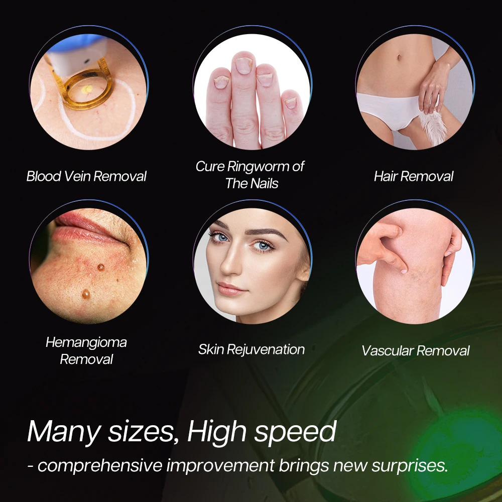 Alexpulse Nd Yag 755Nm 1064Nm Candle Lazer Alexandrite Laser Hair Removal Machine Price