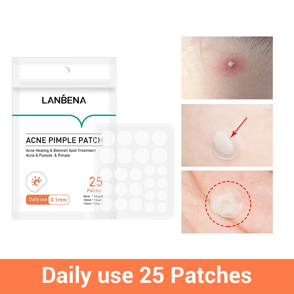 LANBENA акне патч частная марка pinole master анти для дня