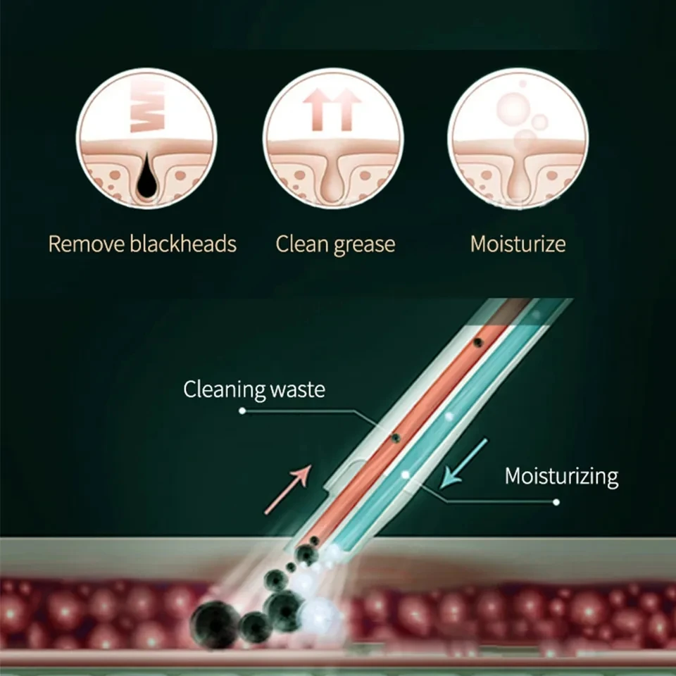 Trending Products Rechargeable Vacuum Blackhead Suction Remover Small Bubble Pore Cleaner Facial Beauty Instrument