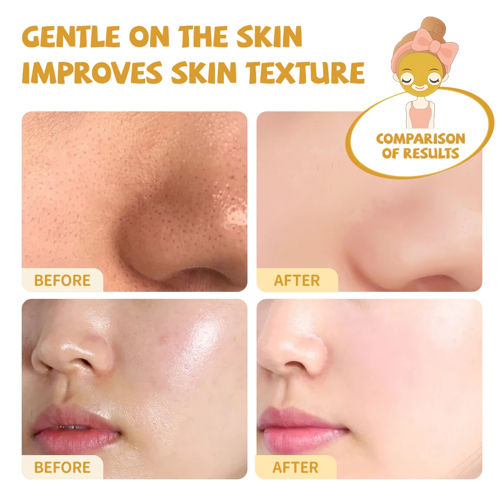 Private Label OEM/ODM Organic Turmeric Vitamin C Facial Mud Mask Face Skin Care Anti-Acne Refining Pores Brightening Clay Mask