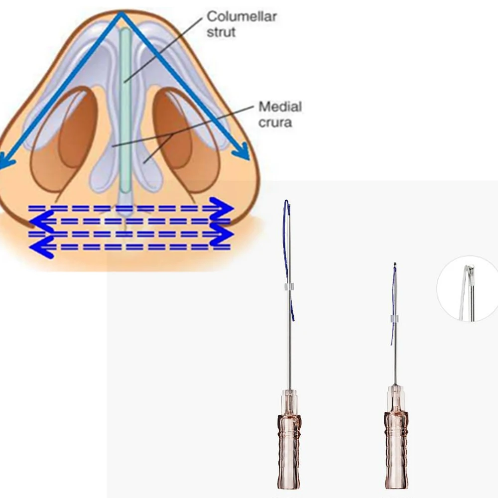 
pdo thread nose korea pdo thread lift pdo cog nose blunt 19G38mm 