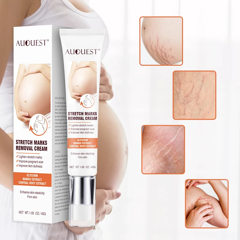 
Private Label Organic Herbal Acne Leg Deep Scar Removal Gel Anti Pregnancy Stretch Mark Removal Repair Cream 