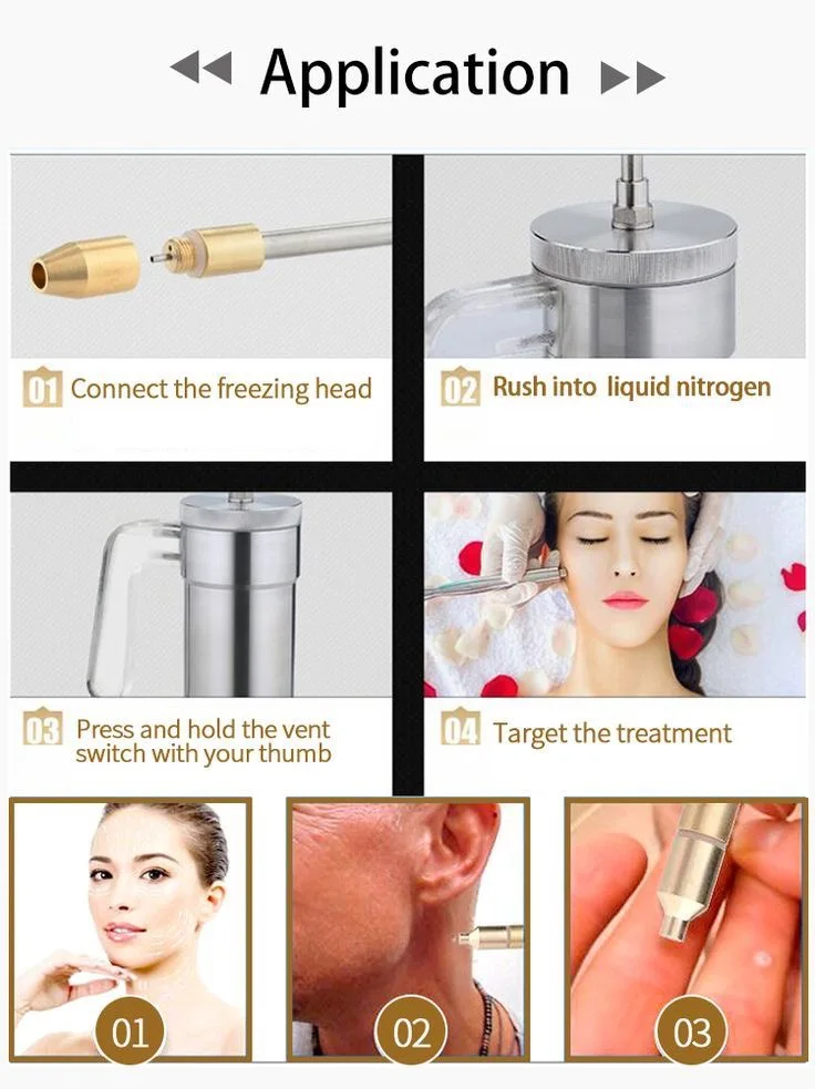 Yds-35 Cell Storage Cylinder Small Aluminium Tank Cryogenic Bull Semen Container 35l Liquid Nitrogen Dewar