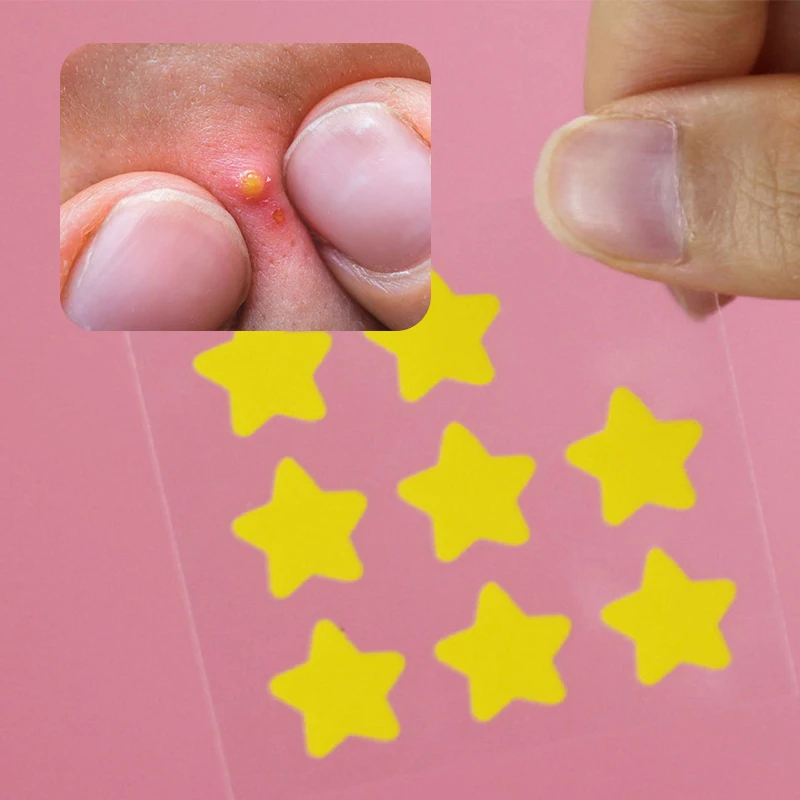 Wholesale Star Acne Dot Pimples Products For Treatment Dots Healing Patches