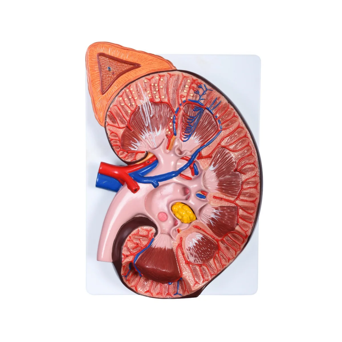 BIX-A3560 Enlarged kidney model with Adrenal gland