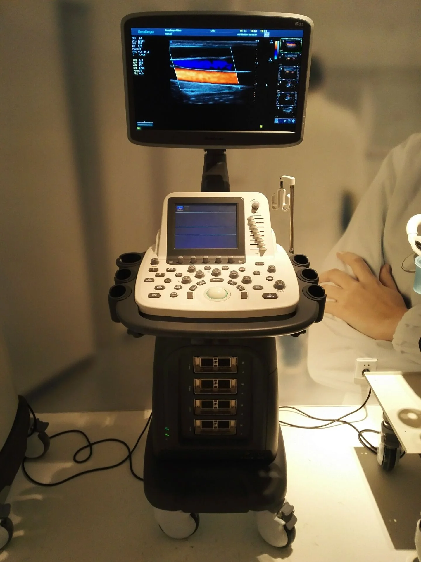 Sonoscape S22 Trolley 4D цветная допплеровская ультразвуковая система, 8 дюймов, сенсорный экран 18,5 дюйма, ЖК-дисплей
