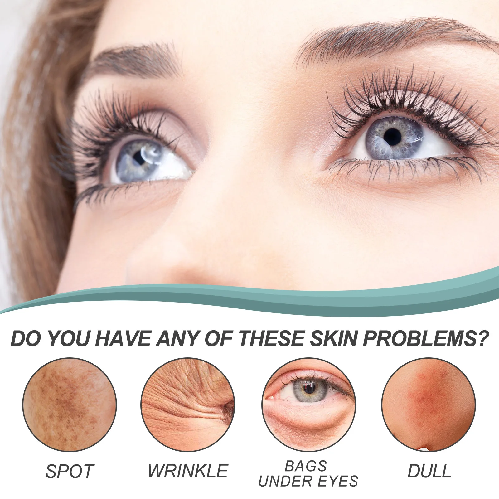 Organic Whitening Anti Freckle Face Care Cream For Pigment Melasma Acne Pimples Dark Spot Corrector with Support customization