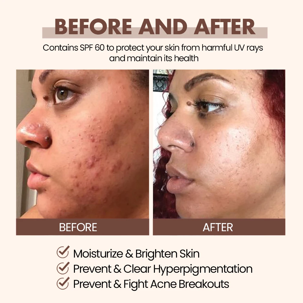 Caramel Skin Care Set Private Label Glowing Brightening Anti Acne Skin Face Toner Serum Facial Cream Body Lotion Skincare Set