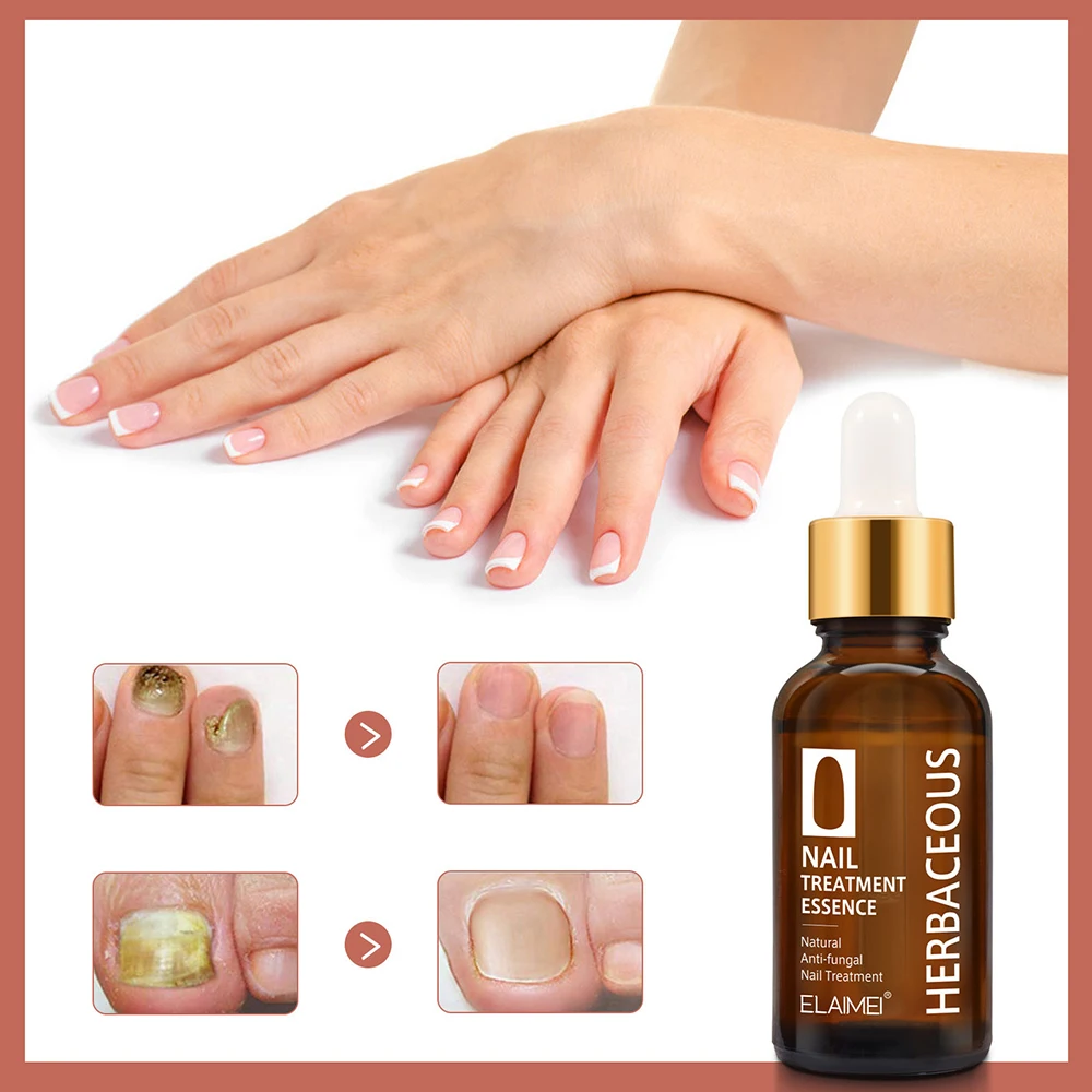 Hot Selling Natural Anti fungal Nail Repairing Essence Serum Treatment