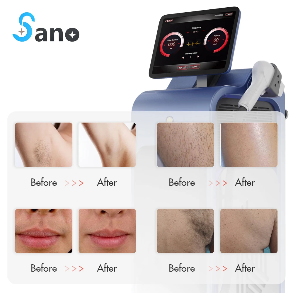 2023 Newest Diode Laser 808 nm  hair removal machine/ 3 wavelength Diode Laser Hair Removal