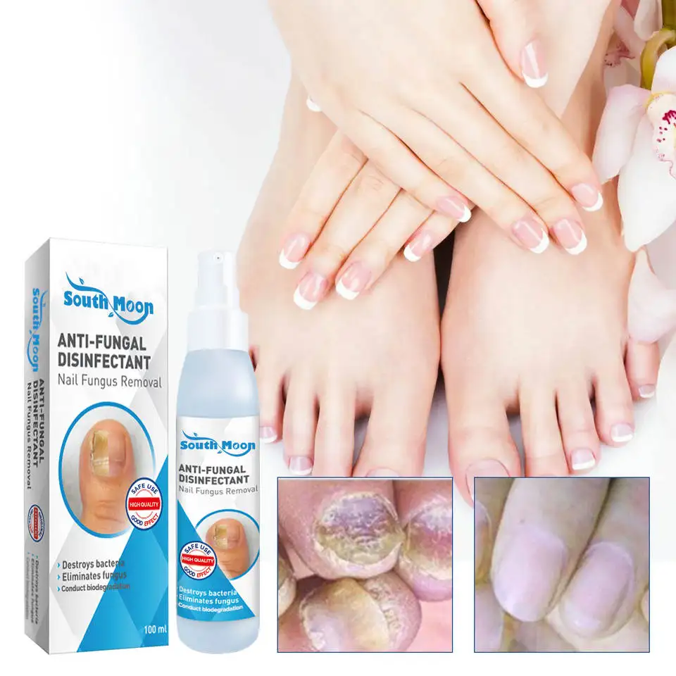 100ml New Anti Fungal Nail Hand Foot Spray Nail Fungus Removal Mist Anti Infection Onychomycosis Nails Repair