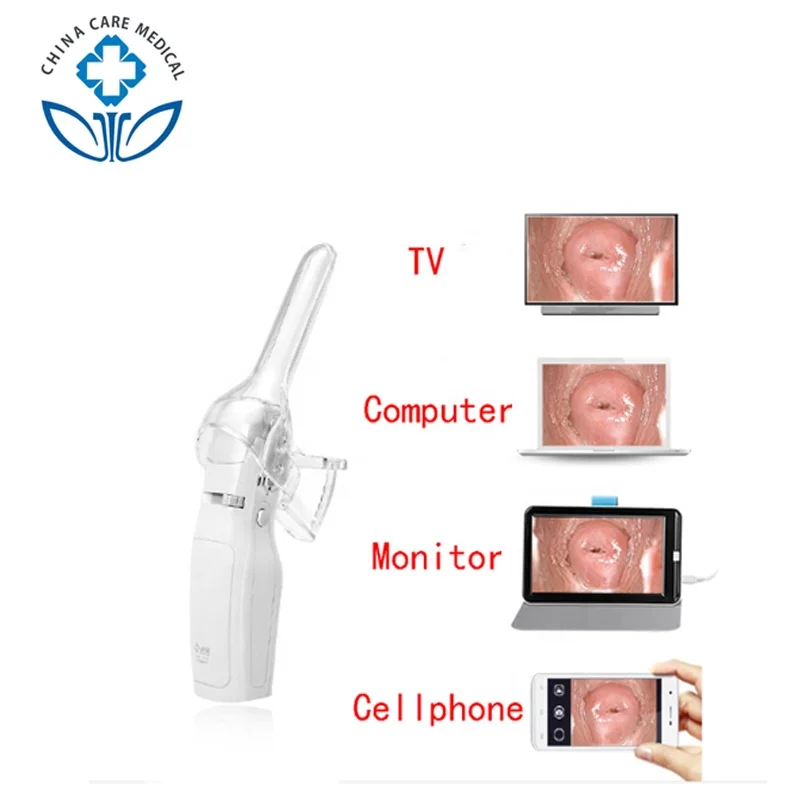 
Portable Electronic Mini Cervical Video Colposcopy Colposcope Culposcope Camera Machine Equipment For Gynecology In China 