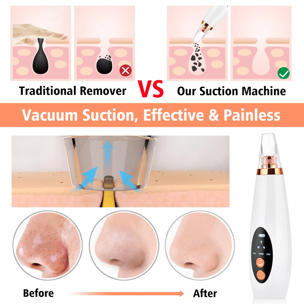 Wholesale Beauty Equipment Electric Nose Pore Cleaner Suction Facial Acne Remover Vacuum Blackhead Remover Tool Kit