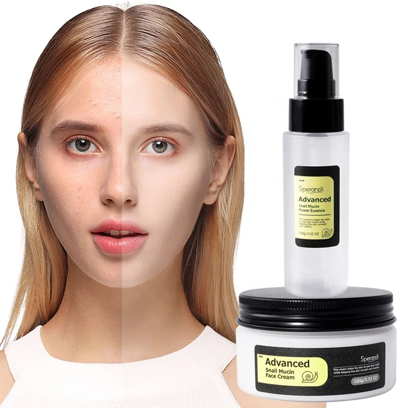Натуральный набор для ухода за кожей улитки с кремом лица сыворотка чувствительной кожи