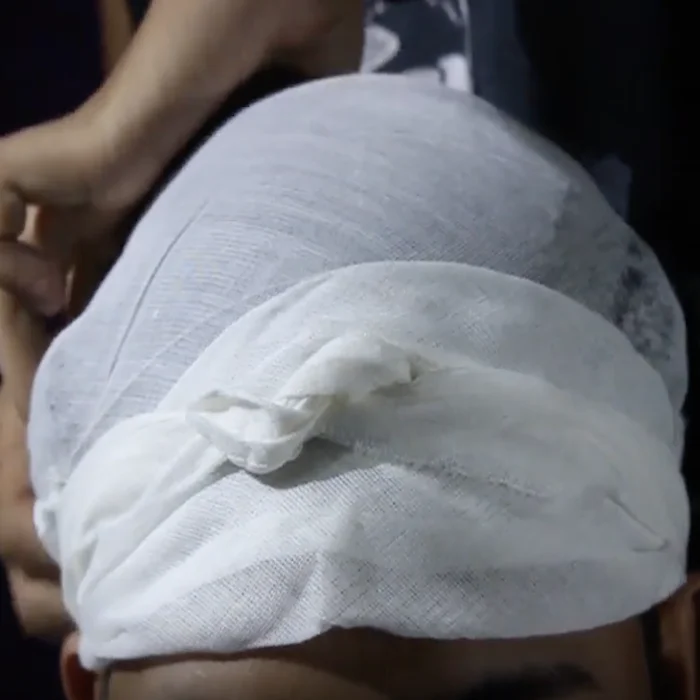 
Cotton 60x58mesh gauze triangular bandage size 90x90x127cm bleached or non bleached 