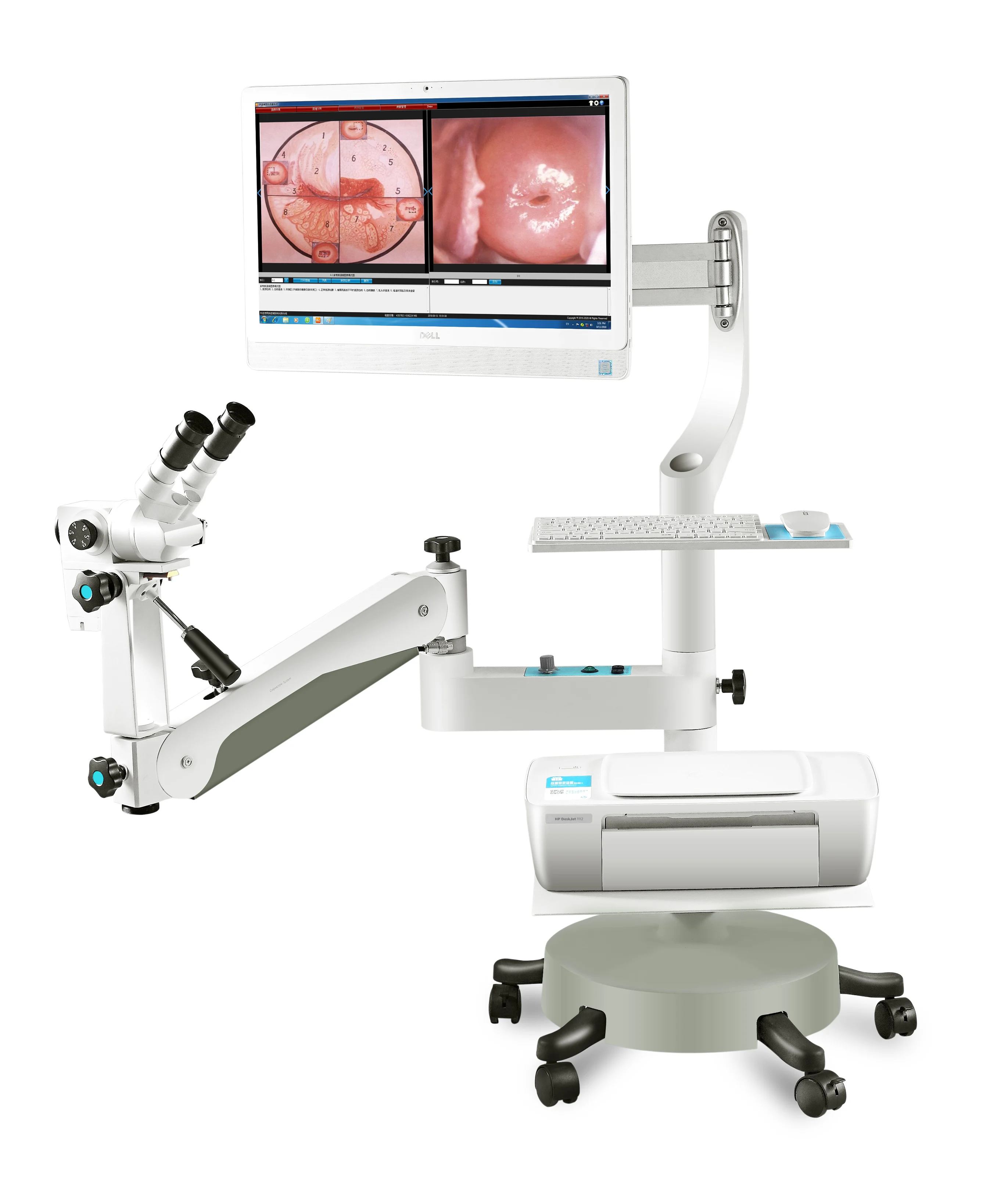 Digital Optical Colposcope System /Video Digital Colposcope with High Resolution and Definition Camera System Colposcopio