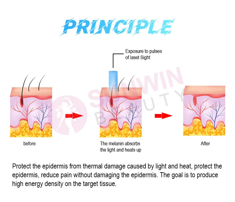 Tattoo Removal Vertical Pain Relief Cryo Therapy Skin Cooling Device Zimmer Cold Air Skin Cooler Avoid Thermal Injury Machine