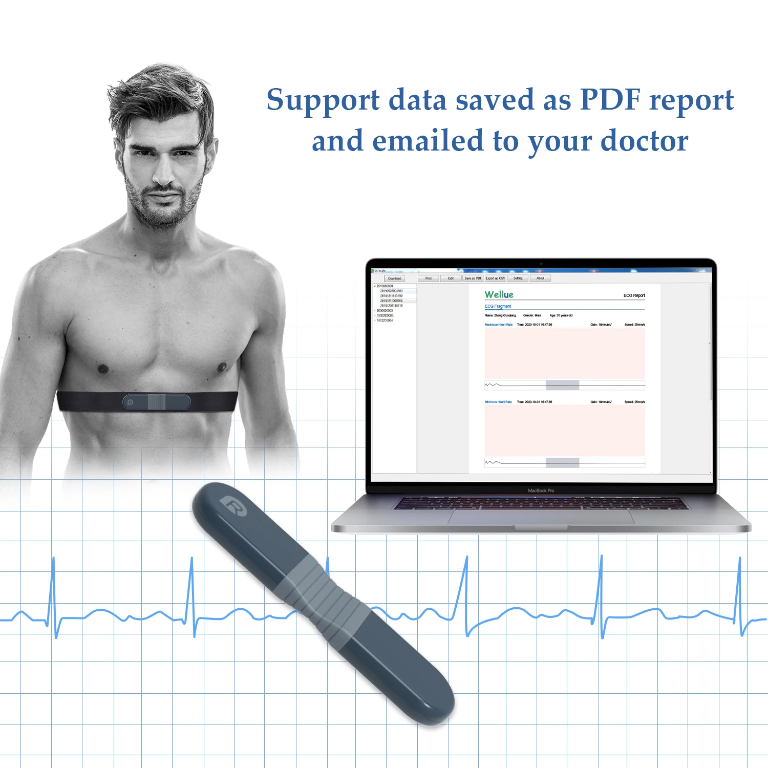Wellue ER1 Medical Equipment Holters Portable Electrocardiogram Monitor Electrode Machine 24 Hor Ecg Recorder With Ai Analysis