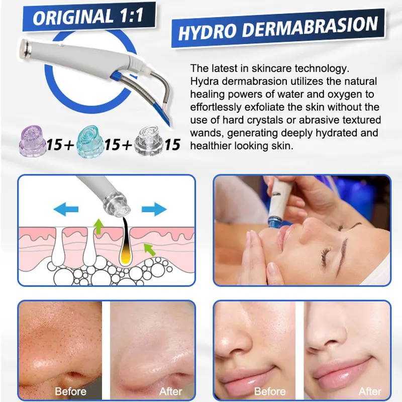 machine facial 14 en 1 hydro microdermabrasion instrument hydra oxigen dermabrasion machine for facial