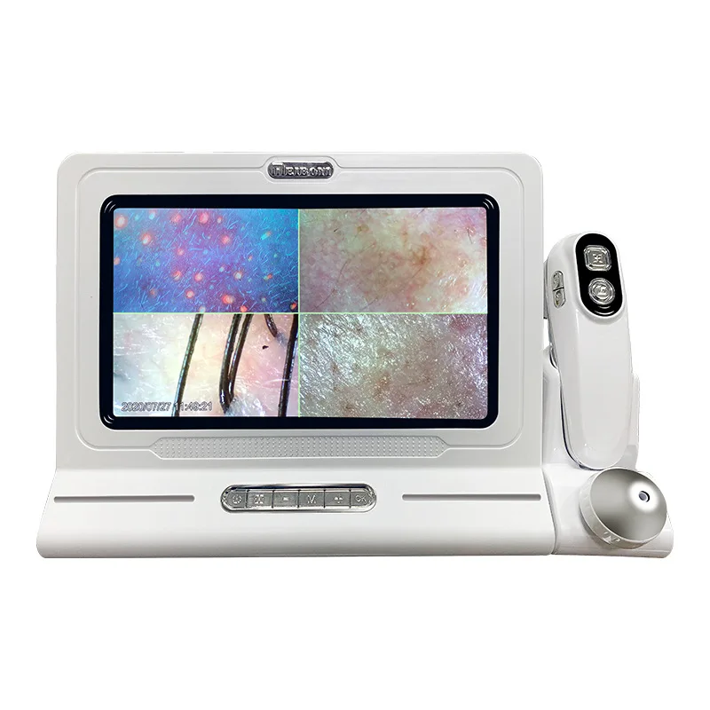 HD Hair Follicles Scalp Scanner Detector Hair Analyzer Skin And Scalp Hair Analysis Machine