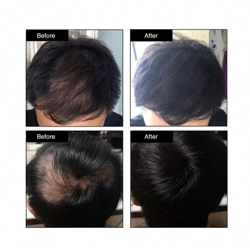 
Instantly Thickening Hair Building Fibers For Hair Loss treatment factory price 