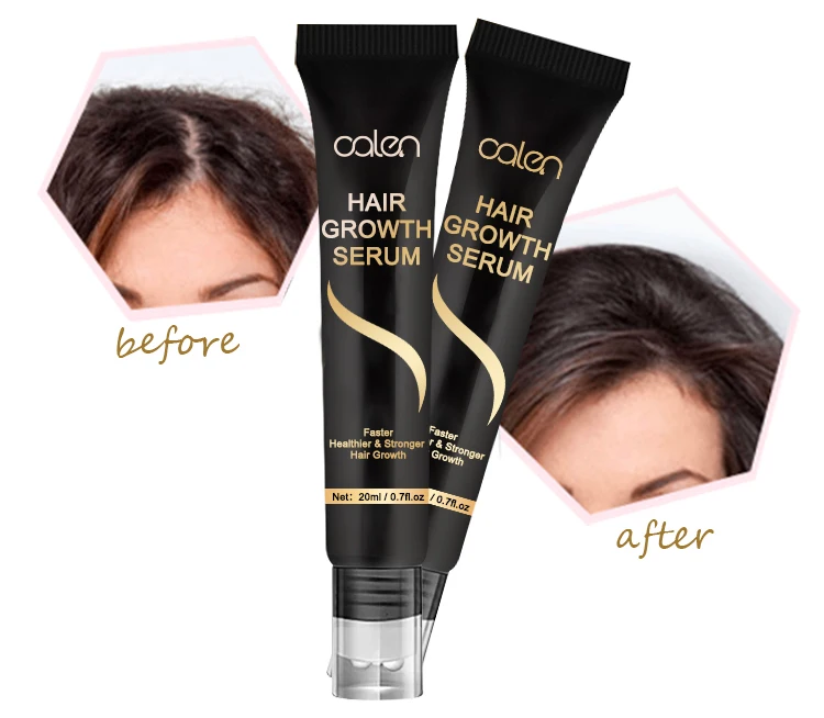 Custom Logo Hair Growth Serum Ginger Powerful Oil Regrowth Organic Hair Serum with Roller