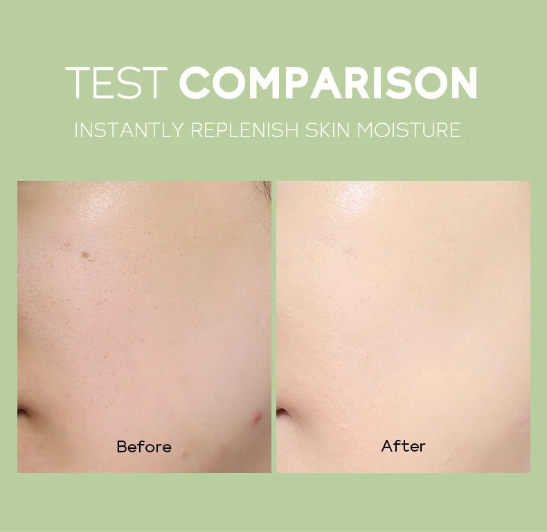 Private Label Moisturizing Anti Aging Wrinkles Pimples Remover Lighten Acne Tea Tree Skin Care Serum