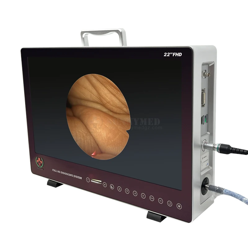 SY-PS050 высокое качество все в одном Full HD эндоскопическая система для лапароскопии гистероскопии артроскопии