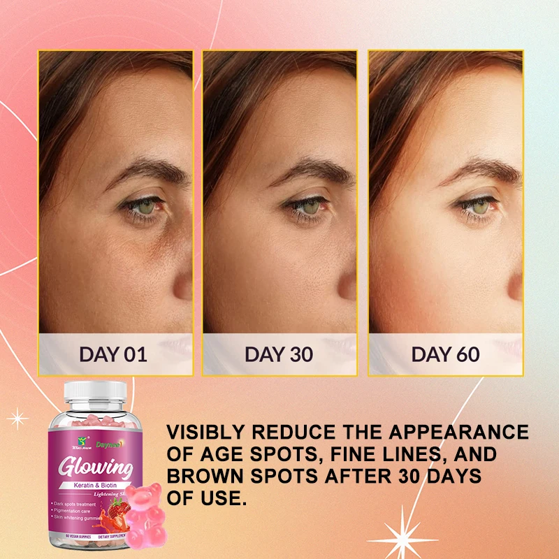 Winstown daynee skin glowing gummies keratin biotin lightening beauty OEM whitening glowing gummies for skin