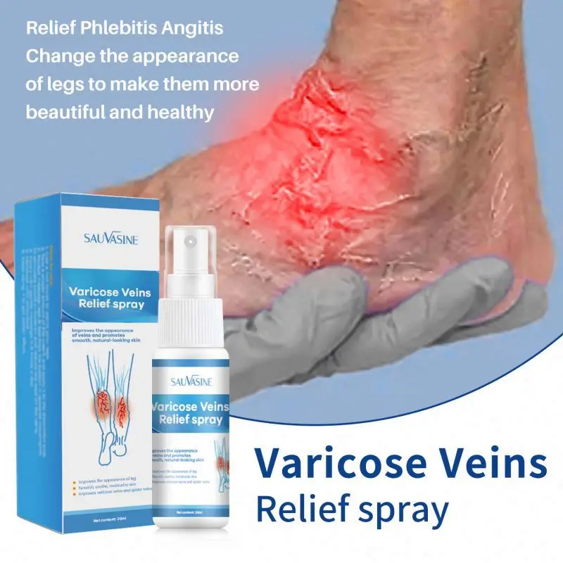 Spray Relief Phlebitis Angiitis Remedy Patch Spider Veins Edema Nerve Pain Earthworm Leg treatment cream Varicose Vein Spray