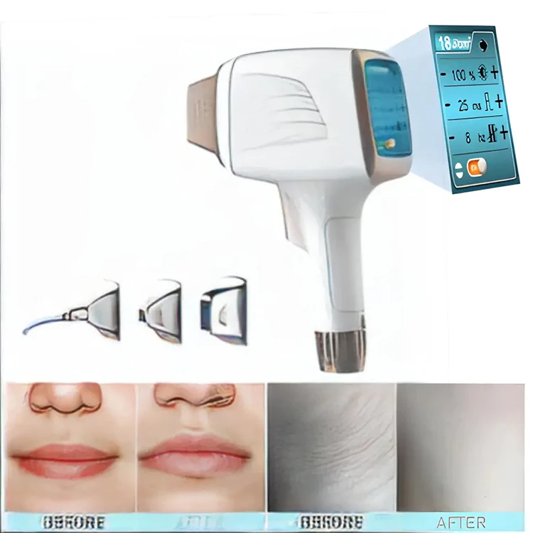 Hot Sale 2 In 1 808Nm Diode Laser Hair Removal Machine Germany Diode Laser Hair Removal Machine